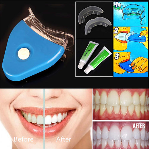 Advanced LED Teeth Whitening Kit | Home Dental Bleaching Oral Gel System